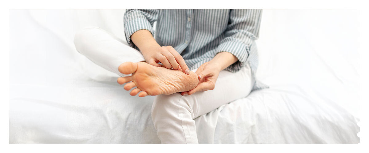 How to Heal Cracked Heels Naturally