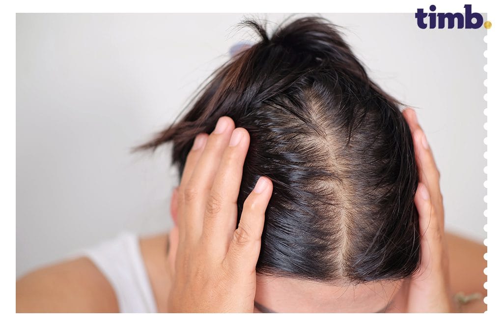 Stress and Hair Fall: How Herbal Supplements Help