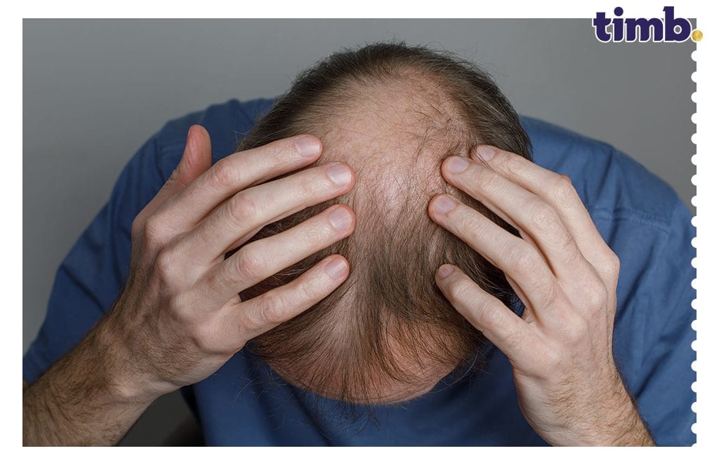 Hair Loss from Water and Location Changes: Causes and Solutions
