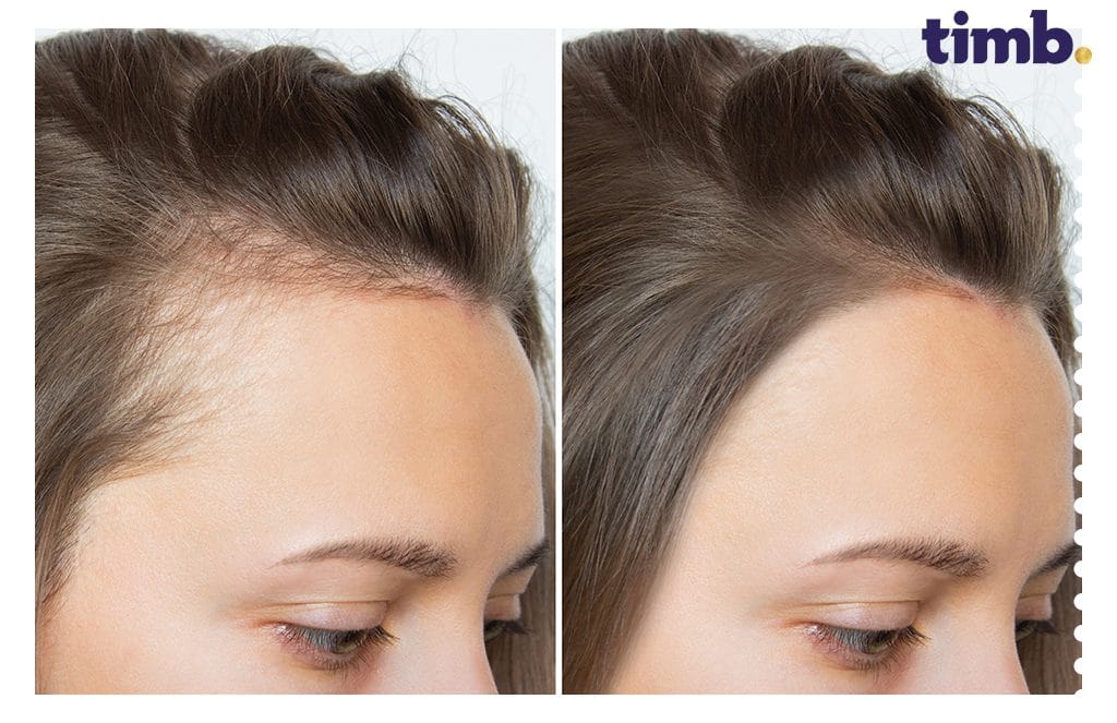 How Natural Scalp Lotions Support Hair Growth After Hair Loss