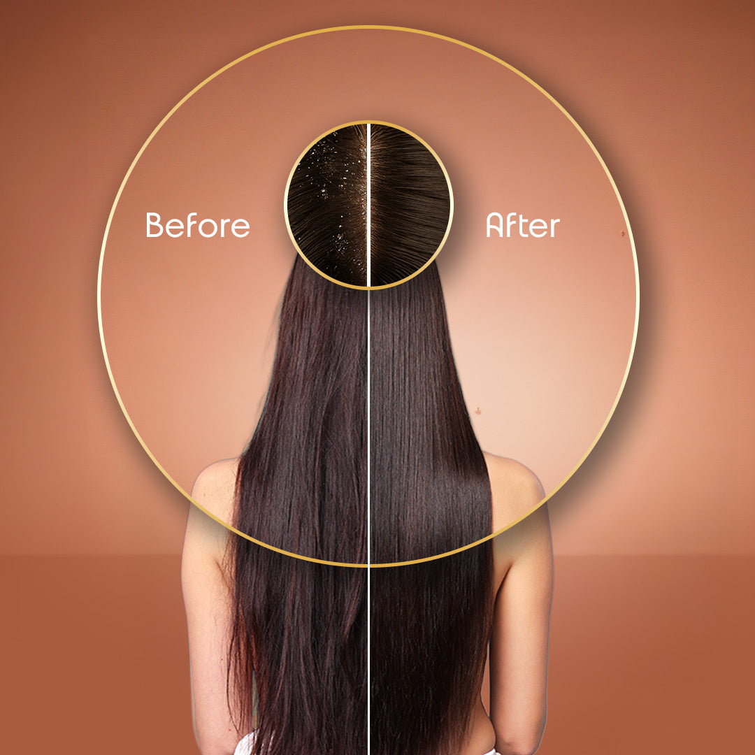 Root Rescue Keratin Hair Oil